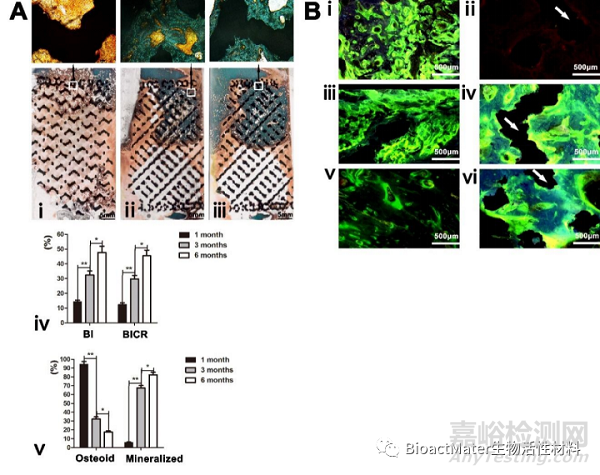 应用3D打印多孔钛合金内植物桥接骨缺损区并成就内植物-骨界面融合