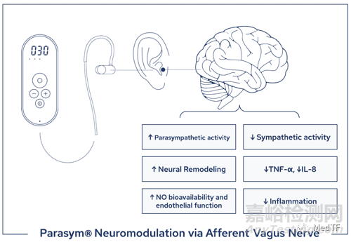 Parasym：无创“无副作用”的心衰疗法