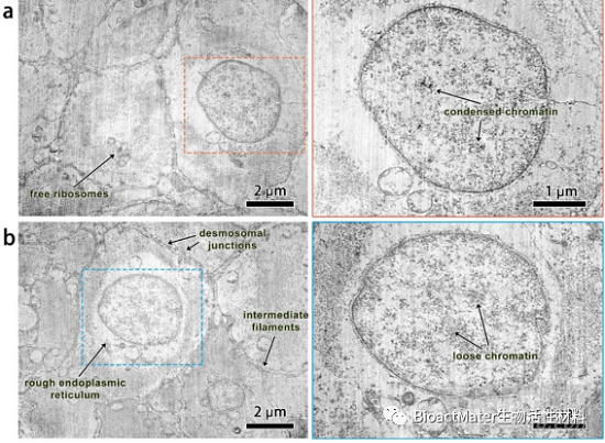 Mg-Sr-Ag合金在动物尿路植入模型中的生物相容性|Bioactive Materials