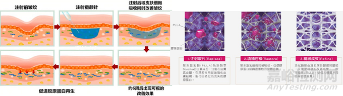 “填充时代”或迈入“再生时代”，再生类注射剂盘点
