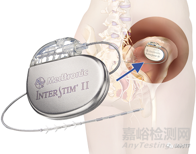 美敦力：开启胫骨神经刺激器临床研究 优化尿失禁治疗方案