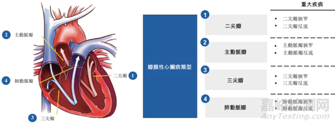 心脏瓣膜之二尖瓣技术解析