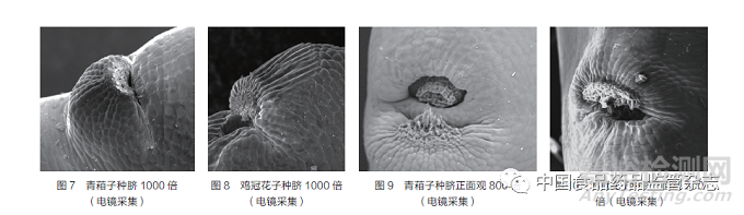 引用本文    连超杰，康帅＊，张南平，郑健，马双成＊.《中国药典》收载种子类药材统计分析与监管建议——以青葙子、鸡冠花子为例[J].中国食品药品监管.2022.03（218）：25-33.