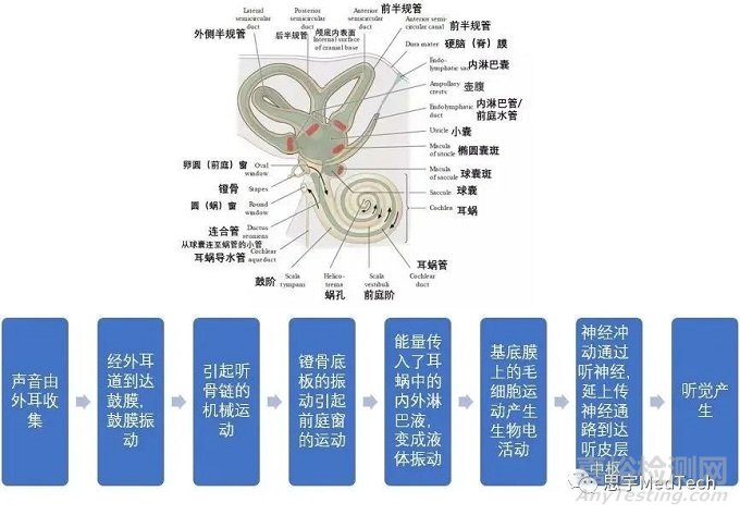 人工耳蜗植入术和三款手术机器人产品盘点