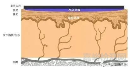 热玛吉技术解析