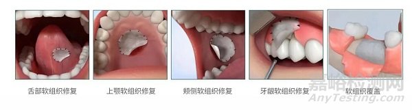 新型生物材料研发进展