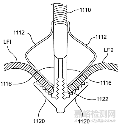 心脏瓣膜技术解析