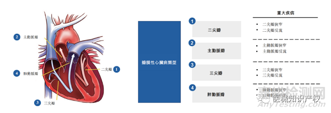 心脏瓣膜技术解析