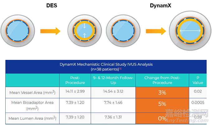 ​DynamX：研究显示能随血管旋转 减少70%血管应力