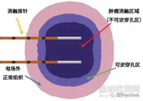 肿瘤消融技术7大核心技术