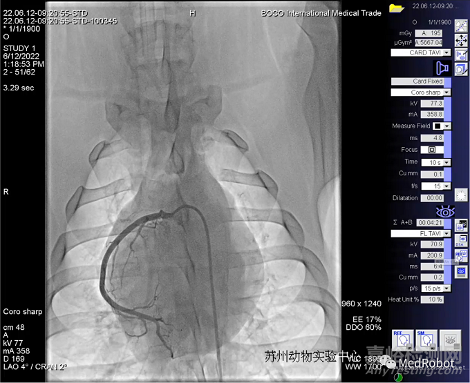微亚医疗完成国内首例异地远程冠脉介入动物实验