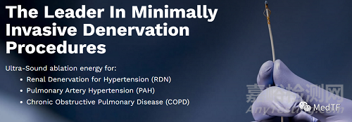 TIVUS：超声消融RDN产品获FDA批准进行IDE研究