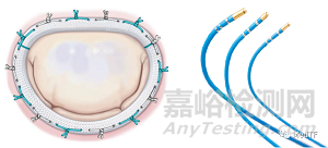 CryoCinch：冷冻定位的瓣环修复 治疗MR和TR