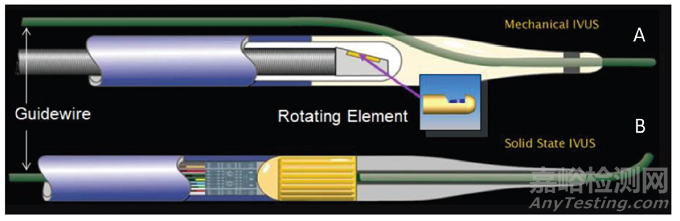 血管内超声（IVUS）的器械构成及技术趋势