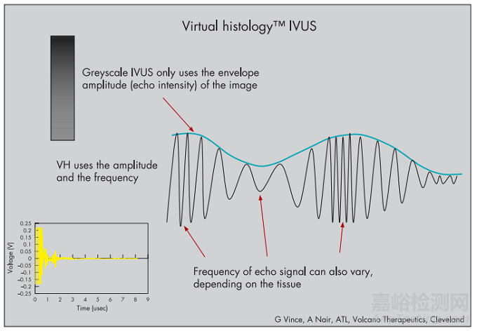血管内超声（IVUS）的器械构成及技术趋势