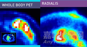 器官靶向PET获批FDA