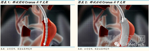 人工血管技术、公司与产品盘点