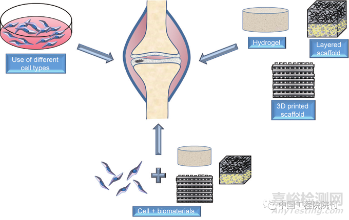 膝关节骨性关节炎治疗的再生工程