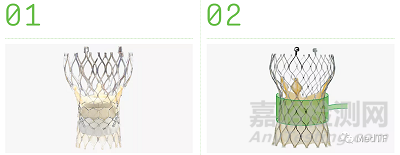 ShortCut：有效预防TAVR术引发冠状动脉闭塞