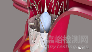 Aortoseal ：具有缝合功能的EVAR覆膜支架