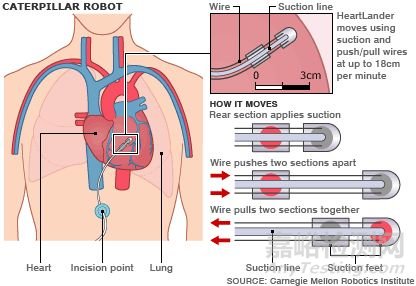 Heartlander Robot：心外科爬行机器人 简化手术