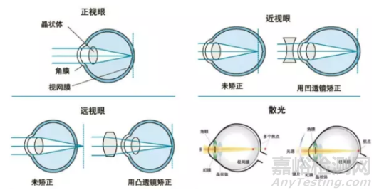 准分子激光角膜屈光治疗仪临床试验设计思路