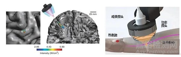 物理因子辅助运动和感觉康复的研究介绍与应用现状