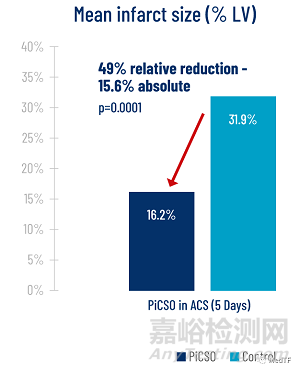 PiCSO：FDA批准革命性急性心肌梗死进行IDE研究