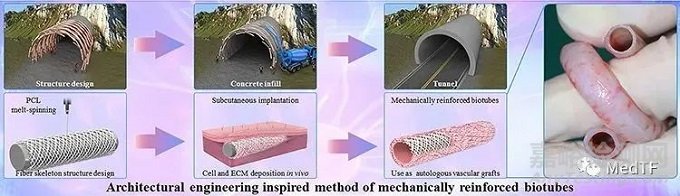 PULSSIBLE：生物型人工血管完成首例临床入组