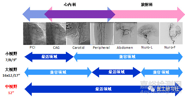 数字减影血管造影DSA发展趋势