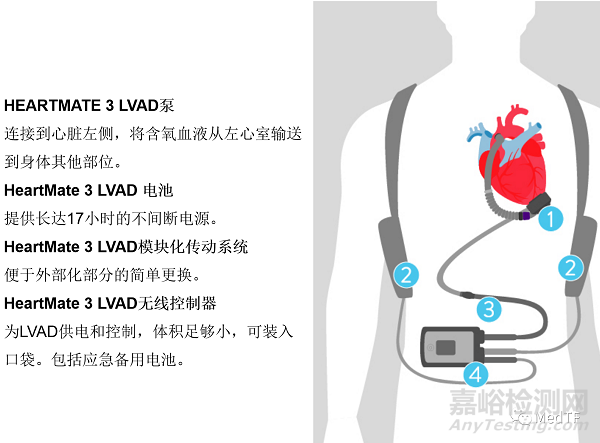 HeartMate 3：最新研究显示至少能延长患者5年寿命