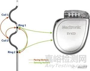 EV ICD：美敦力血管外ICD实现98.7%的除颤成功率