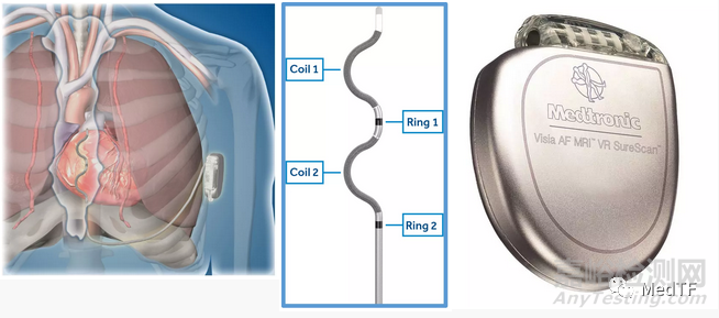 EV ICD：美敦力血管外ICD实现98.7%的除颤成功率