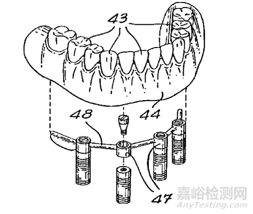 牙种植体技术与专利分析