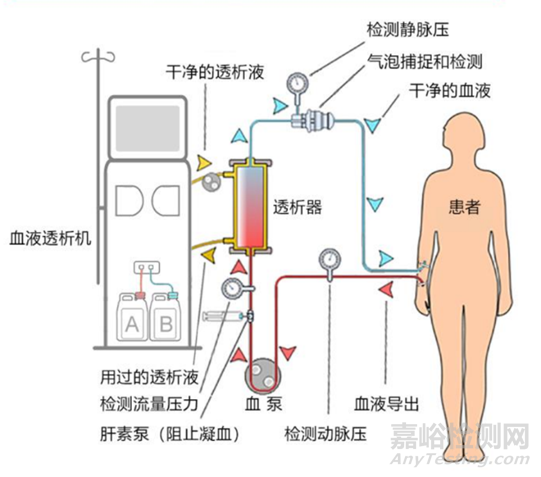 血液透析产品结构组成及相关核心技术与部件