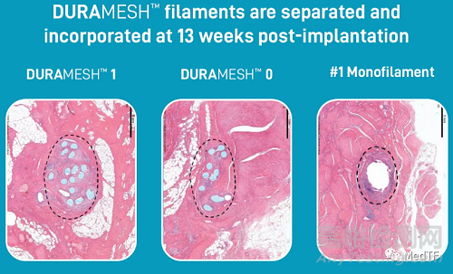 DURAMESH：全球唯一的网状缝线 缝线二十年来最大创新