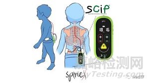 SCiP：无创神经调节治疗脑瘫 让患者拥有自主感觉运动功能