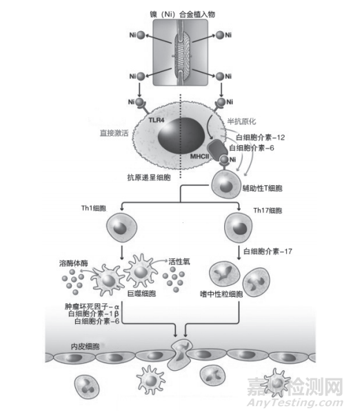 镍合金医疗器械过敏的研究进展