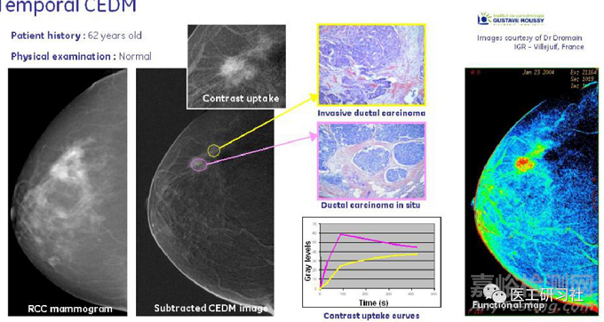 乳腺影像诊断设备及新技术进展