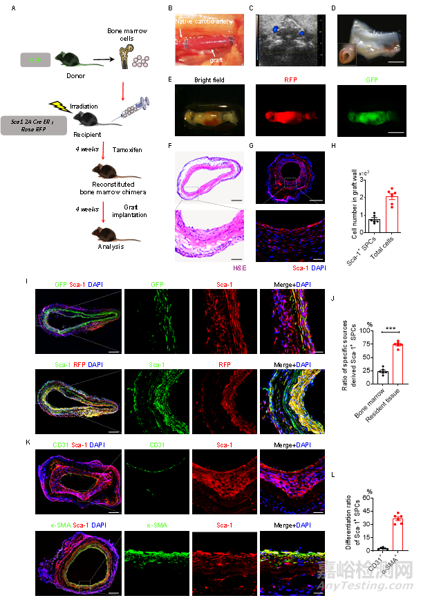 种抗体功能化修饰的人工血管通过选择性捕捉血管干/祖细胞促进组织再生