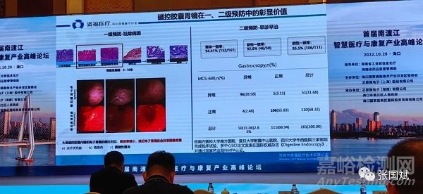 胶囊内窥镜的现状与未来发展趋势