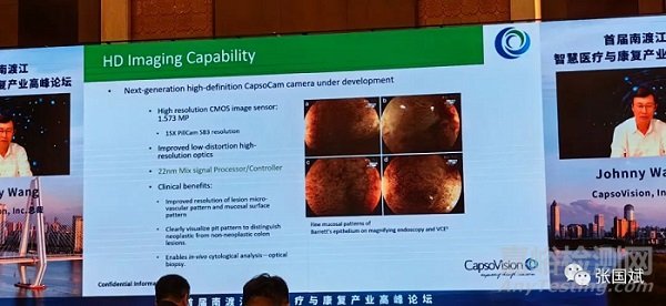 胶囊内窥镜的现状与未来发展趋势