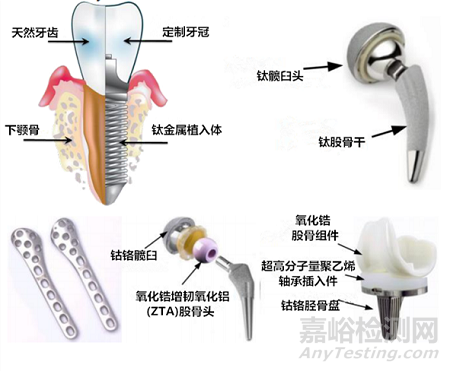 钽涂层在植入医疗器械中的应用