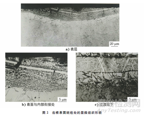 大模数齿轮齿根表面斑疤缺陷原因