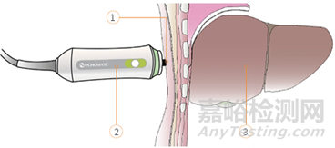 【CMDE】定量剪切波超声肝脏测量仪注册审查指导原则意见征求中