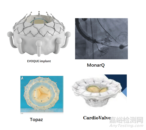 2022年结构性心脏病医疗器械年度盘点