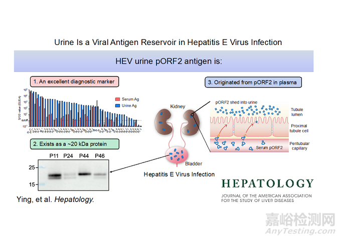 尿液测肝炎最新研究
