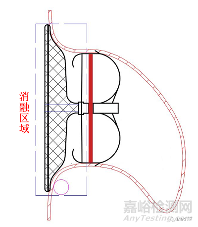 E-SeaLA：全球首创具有PFA消融功能的左心耳封堵器