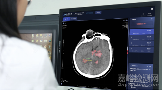 数坤科技颅内出血CT图像辅助分诊软件获批上市