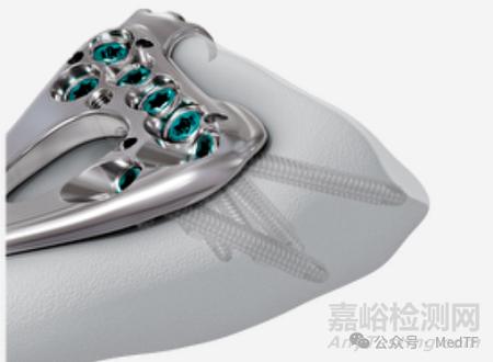 VOLT：强生推出全新的骨折内固定系统